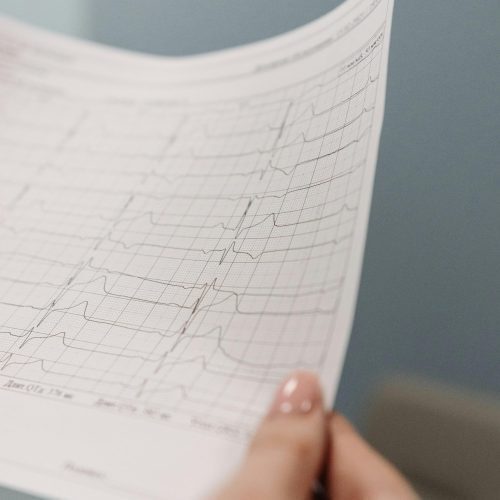 Cardiac care and monitoring